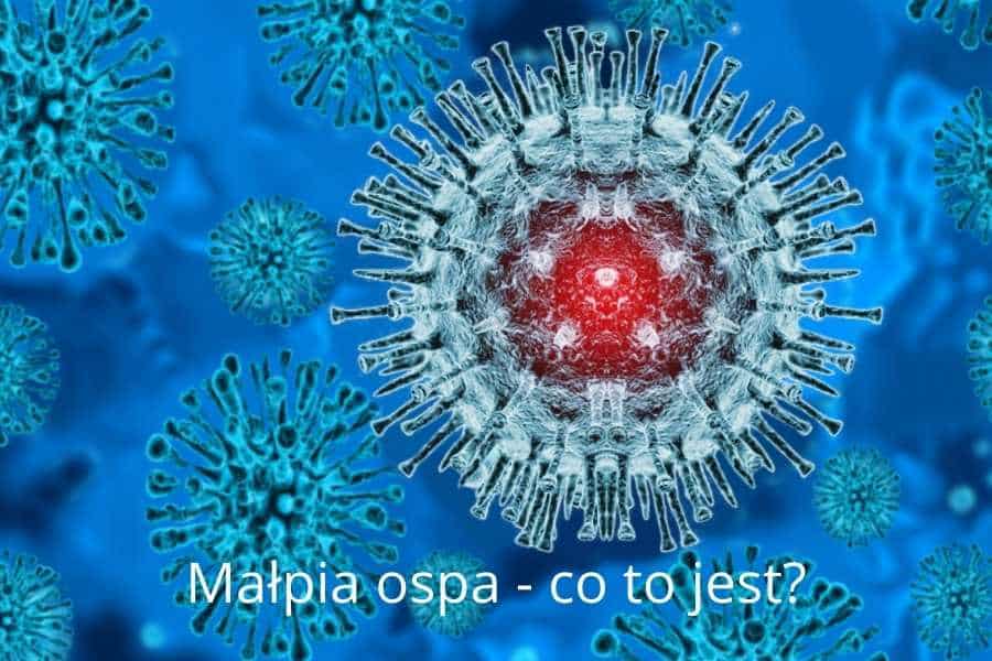 Małpia ospa