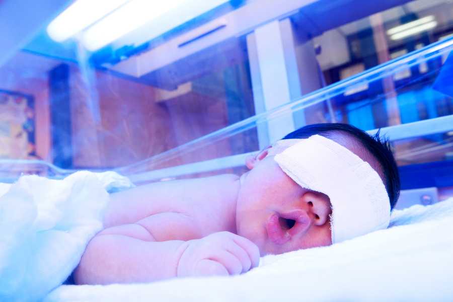 Noworodek z żółtaczką leczony fototerapią