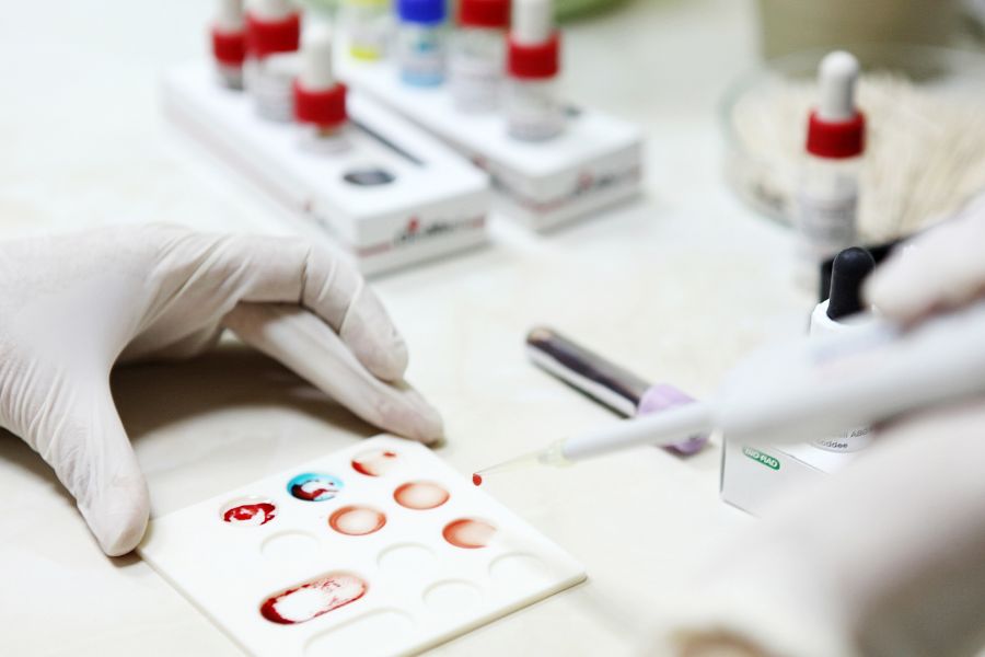 Niezgodność grupowa ABO u noworodka